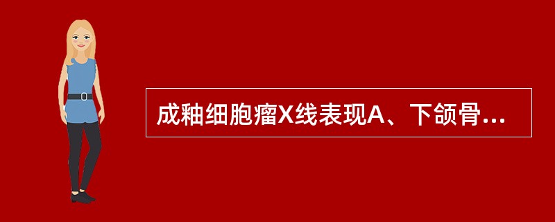 成釉细胞瘤X线表现A、下颌骨体有大小不等的多房阴影 B、下颌骨内有单房透明阴影,