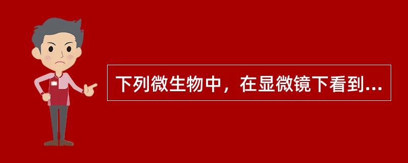下列微生物中，在显微镜下看到形状不是丝状的是（　　）。[2010年真题]