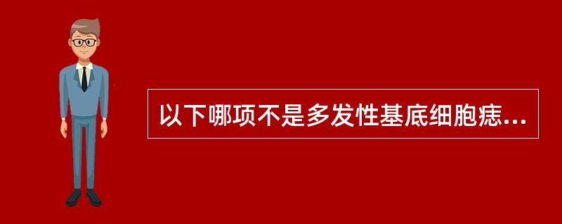 以下哪项不是多发性基底细胞痣综合征的表现( )。