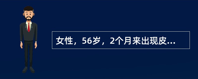 女性，56岁，2个月来出现皮肤及巩膜黄染，并进行性加重，伴乏力、消瘦，排陶土样便，尿色深。查体：皮肤巩膜黄染，腹平软，无压痛、反跳痛及肌紧张，Courvisier征(+)，辅助检查：总胆红素明显升高，