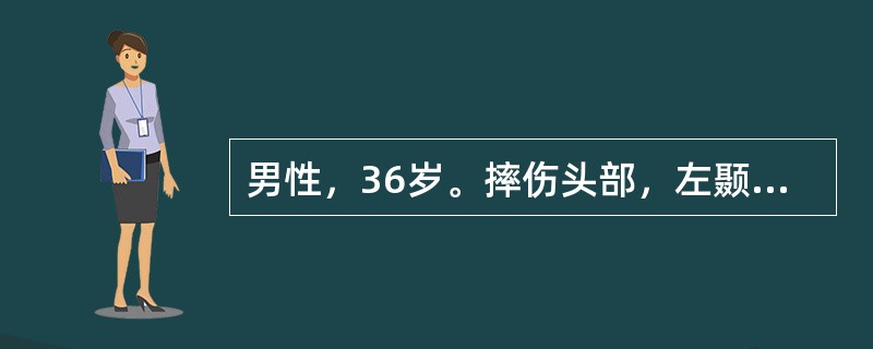 男性，36岁。摔伤头部，左颞部着力，昏迷，左瞳孔散大。X线摄片示左颞骨折线跨过脑膜中动脉。最可能的诊断是()