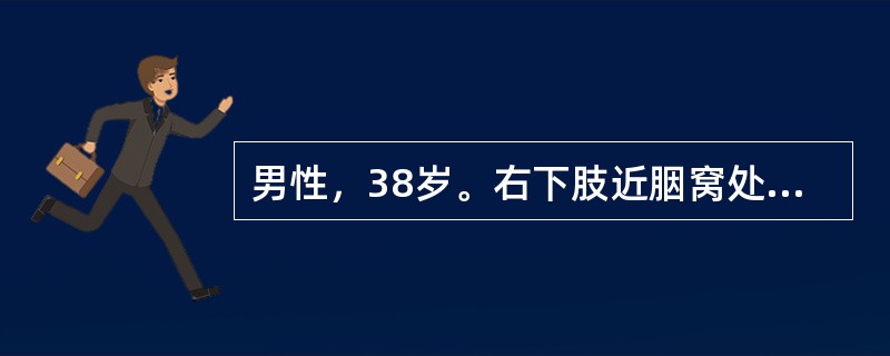 男性，38岁。右下肢近胭窝处被刀刺伤1周后出现搏动性肿块，逐渐增大伴右下肢麻木。查体：右下肢苍白，腘窝部搏动性肿块大小为5cm×4cm，附近有收缩期杂音。可诊断为()