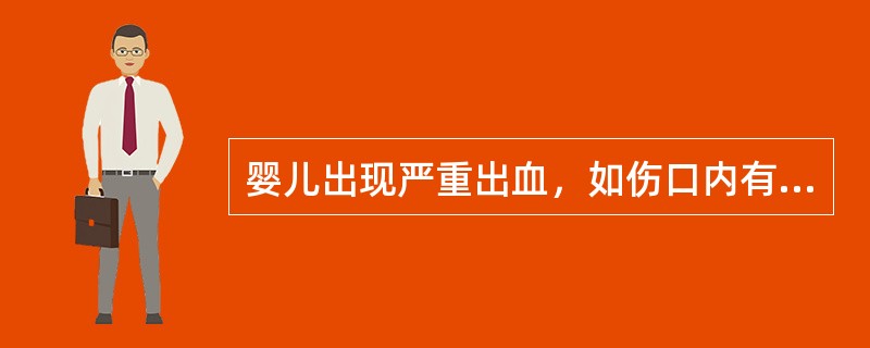 婴儿出现严重出血，如伤口内有异物，可以压迫正上面。（）
