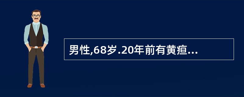 男性,68岁.20年前有黄疸、食欲缺乏病史,临床诊断为“肝炎”.近2个月来食欲缺