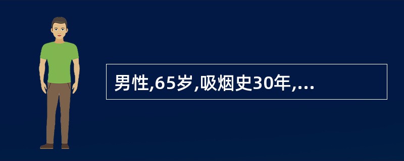 男性,65岁,吸烟史30年,反复咳嗽、咳白色泡沫痰20余年,气促10年,近2天因