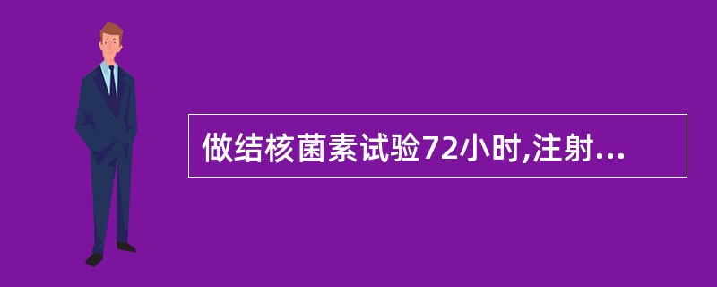 做结核菌素试验72小时,注射局部出现水疱和坏死,其范围平均直径12mm,判断结果