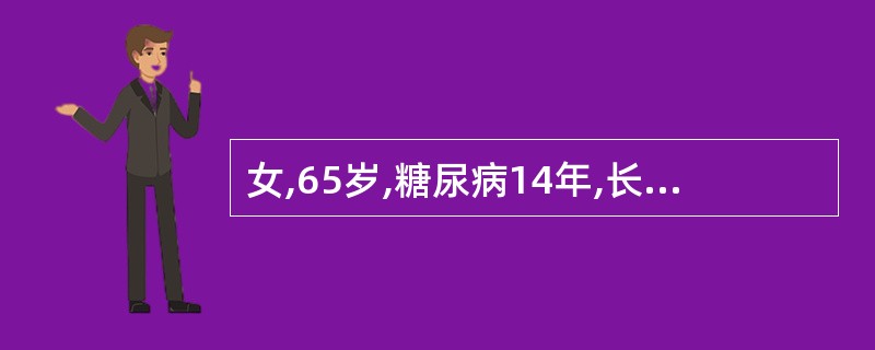 女,65岁,糖尿病14年,长期用D860治疗,近诊断为糖尿病肾病,并发现血肌酐升