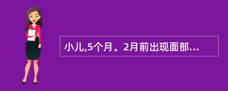 小儿,5个月。2月前出现面部灰暗,哭闹及吃奶时出现发绀。查体:较瘦,口周发绀,心