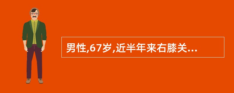 男性,67岁,近半年来右膝关节隐痛,白天活动后加重。X线片示双膝关节间隙变窄,关