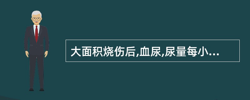 大面积烧伤后,血尿,尿量每小时10~15mlA、低渗性脱水 B、等渗性脱水 C、