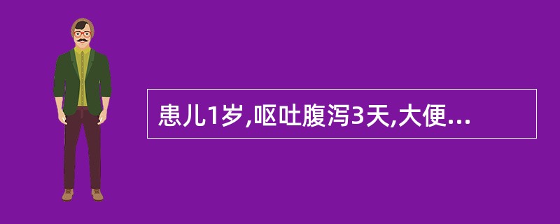 患儿1岁,呕吐腹泻3天,大便每天12次,稀水样,量多,呕吐每天3次,前囟门明显凹