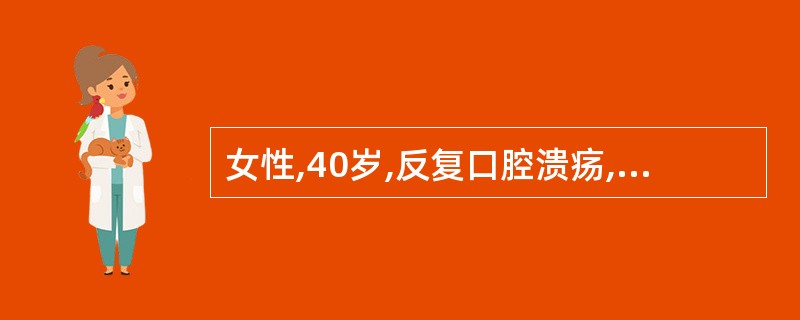 女性,40岁,反复口腔溃疡,乏力,口干,间断心悸,超声心动图提示心包积液,24小