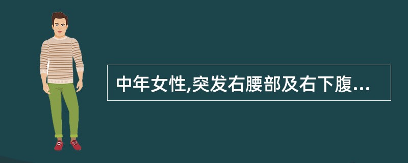 中年女性,突发右腰部及右下腹部剧痛,伴恶心。超声显示右肾轻度积水,最可能的诊断是