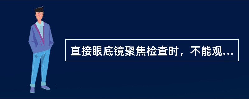 直接眼底镜聚焦检查时，不能观察到的结构是（）。