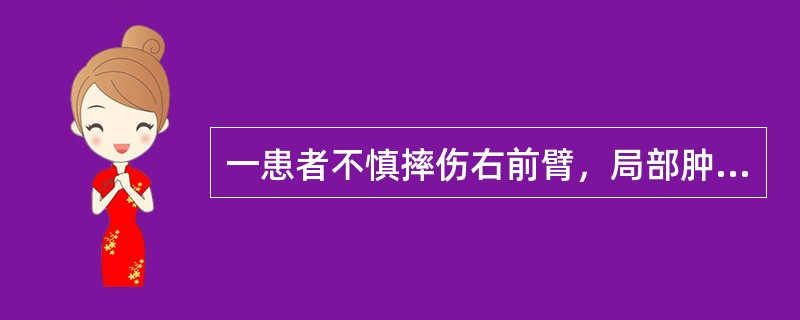 一患者不慎摔伤右前臂，局部肿胀、畸形，旋转功能障碍，上段内侧可扪及骨擦感，掌指关节不能主动伸直，拇指不能外展，手背虎口区感觉存在，腕关节能自主活动；X线示右尺骨上段骨折并桡骨小头脱位，最可能的诊断是（