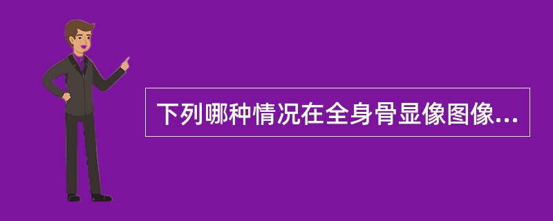 下列哪种情况在全身骨显像图像上表现为"冷区"()