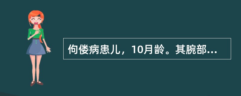 佝偻病患儿，10月龄。其腕部X线摄片示骨骺端呈杯口状，毛刷状改变，血清钙85mmol／L（7.4mg／dl），磷8mmol／L（5.8mg／dl），碱性磷酸酶40U（布氏）。下列佝偻病体征中，哪一点不