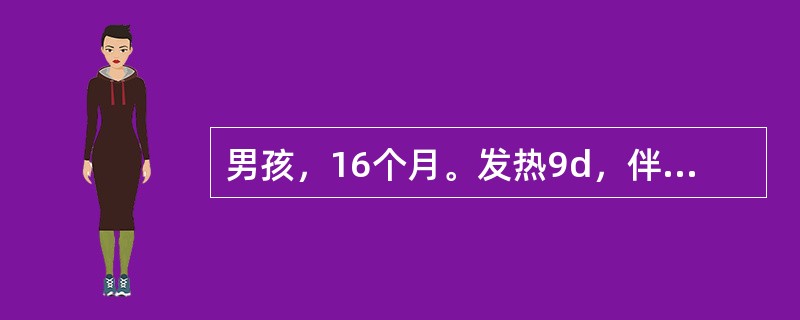 男孩，16个月。发热9d，伴反复皮疹住院。体检：体温39℃，眼结膜充血，口唇鲜红、干裂，草莓舌，皮肤有浅红色斑丘疹，细小似猩红热样，颈淋巴结呈花生米大，心率140／min，两肺呼吸音粗，腹软，肝、脾不