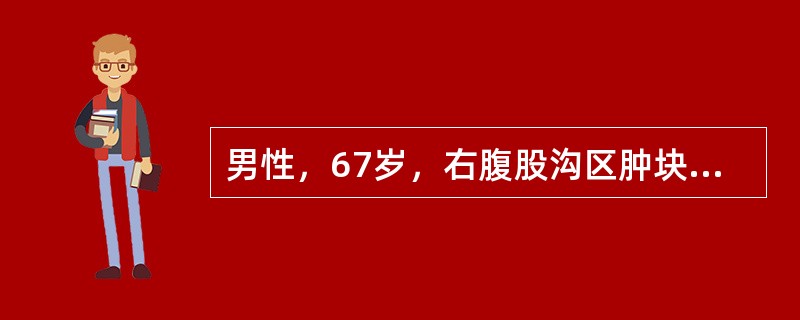 男性，67岁，右腹股沟区肿块1年，渐增大，但晚间卧床后肿块缩小。昨突发右下腹痛，伴呕吐2次，腹痛阵发性加重。体格检查：全腹平软，右下腹压痛，无肌紧张，肠鸣音8～12次／分，偶闻气过水声。进一步体格检查