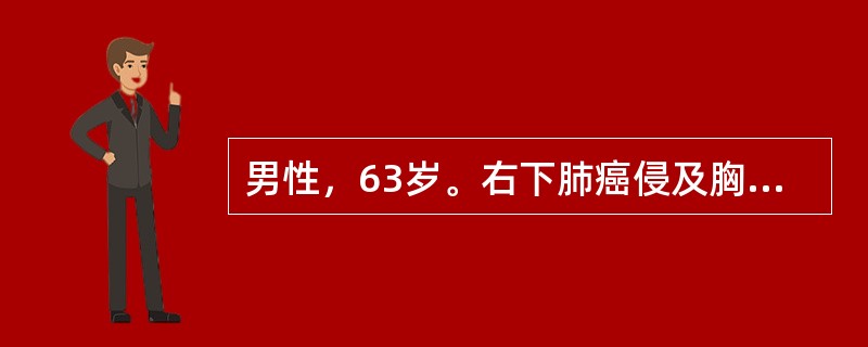 男性，63岁。右下肺癌侵及胸壁。胸部CT显示肺门、纵隔无肿大淋巴结，未发现远处转移。。该病例TNM分期为