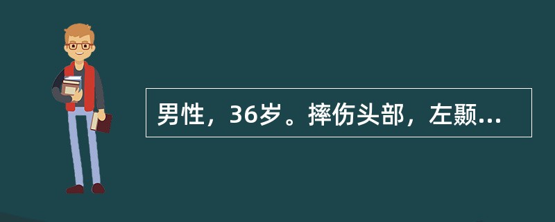 男性，36岁。摔伤头部，左颞部着力，昏迷，左瞳孔散大。X线摄片示左颞骨折线跨过脑膜中动脉。最可能的诊断是