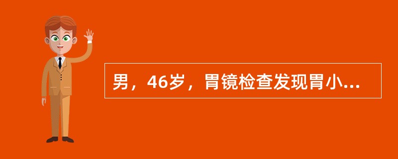 男，46岁，胃镜检查发现胃小弯侧2cm×0cm浅表溃疡，病理诊断为腺癌。手术切除标本病理示病变累及黏膜层及黏膜下层，小弯侧有2枚淋巴结转移。应诊断为（）