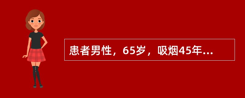 患者男性，65岁，吸烟45年，咳嗽、近1个月余偶有血痰，伴乏力、低热，体格检查发现，左胸饱满，语颤减弱，叩诊为浊音，左中下肺呼吸音消失。该病人肺部病变应考虑