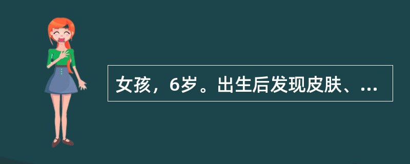 女孩，6岁。出生后发现皮肤、黏膜色素增深，阴蒂肥大，大阴唇似阴囊。体检：血压115／90mmHg，外阴男性化。血钠150mmol／L，颊黏膜刮片X小体阳性（）