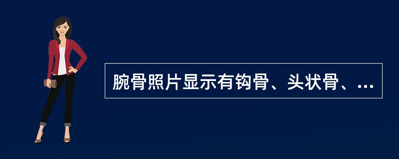 腕骨照片显示有钩骨、头状骨、三角骨，被摄者最可能的年龄：