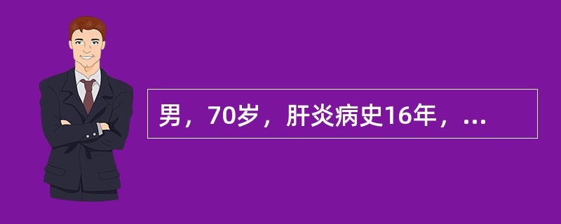 男，70岁，肝炎病史16年，近二月来纳差、消瘦，肝区疼痛。查体：轻度黄疸，面部有蜘蛛痣，腹膨隆，肝肋下4cm，质硬、压痛。脾肋下3cm，移动性浊音阳性。临床上应首先考虑的是