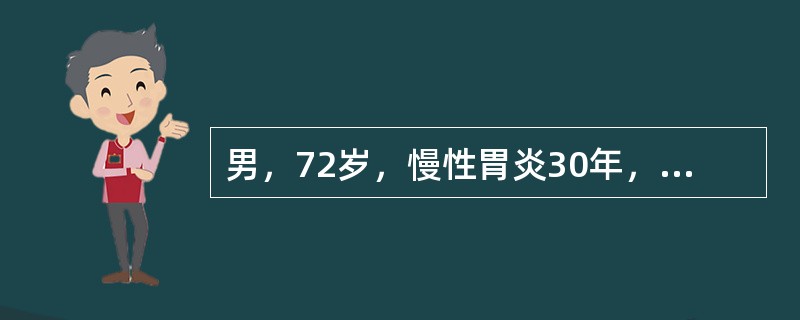 男，72岁，慢性胃炎30年，近2周出现发作性胸痛，伴反酸、胃灼热、呃逆。要确诊胃食管反流病，最主要的检查是