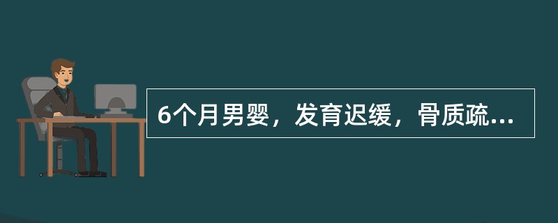 6个月男婴，发育迟缓，骨质疏松，全身皮肤苍白、黄染，肝脾大。检验：HGB60g/L，WBC6．8×109/L，PLT100×109/L，HGBF>80％，Coombs试验阴性，血片可见靶形细胞，