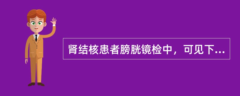 肾结核患者膀胱镜检中，可见下列哪项不正确（）