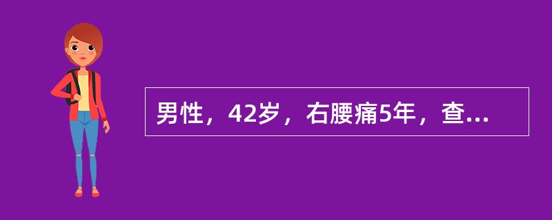 男性，42岁，右腰痛5年，查B超示右肾中度积水；腹部平片可见右中段输尿管有一直径2cm结石，肾盂静脉造影，左肾显示正常，右肾盏显示扩张，肾盂未显示，行右肾穿刺造影右肾中度积水，输尿管上段扩张2cm，结