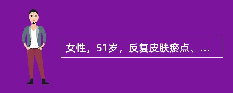 女性，51岁，反复皮肤瘀点、瘀斑7年，因发热伴鼻出血3天入院。查全身皮肤散在瘀斑、瘀点，脾轻度肿大，血小板20×109／L，凝血时间正常，骨髓象示增生活跃，巨核细胞增多，产血小板型巨核细胞缺少。入院第