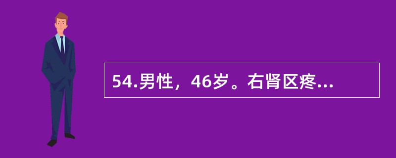 54.男性，46岁。右肾区疼痛，间歇性肾绞痛1个月。尿检：红细胞10～15个/HP，B超检查：左肾积水轻一中度，IVU检查：左输尿管上段有一0cm的结石，结石以上输尿管扩张2cm，双侧肾盂肾盏显影好。