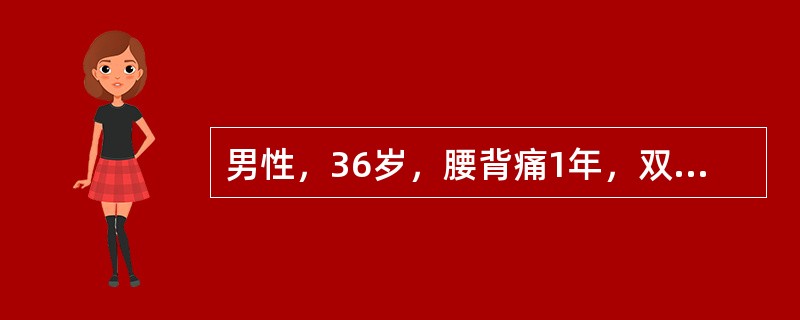 男性，36岁，腰背痛1年，双下肢无力2个月。行脊髓腔碘油造影，造影剂在肿瘤下端造影显示，造影剂在肿瘤下端梗阻，梗阻面造影剂呈“杯口状”充盈缺损，肿瘤影偏一侧，脊髓影被肿瘤推向对侧。根据上述资料该处常见