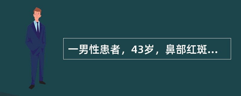一男性患者，43岁，鼻部红斑5年，渐加重。嗜酒。体检：鼻尖部红斑、表面毛细血管扩张、丘疹、脓疱和结节。以下哪项诊断正确