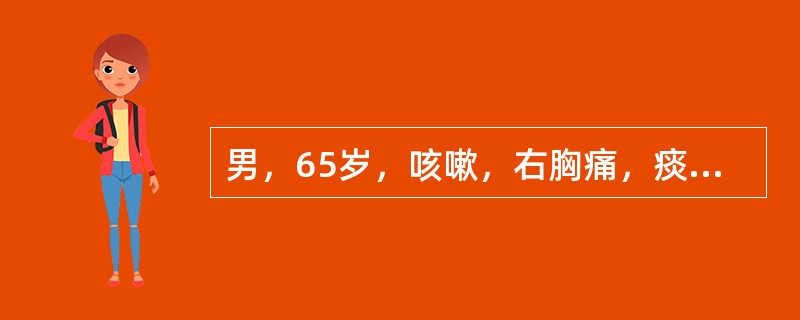 男，65岁，咳嗽，右胸痛，痰中带血丝1周。胸部后前位片示：右肺门影增大，右上肺大片状致密影，水平裂呈反“S”样改变。被阻塞的支气管