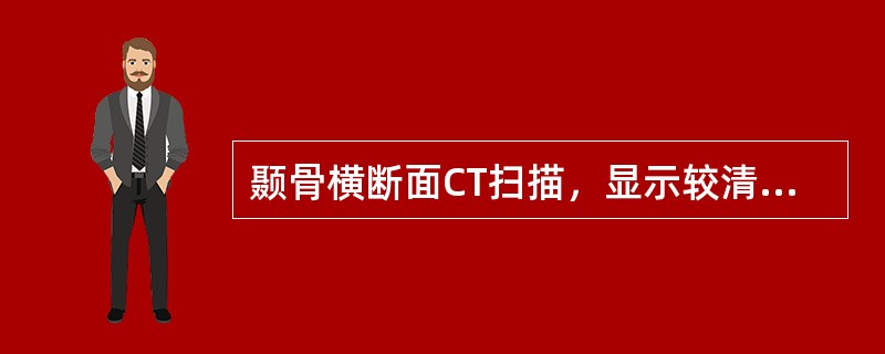 颞骨横断面CT扫描，显示较清楚的为