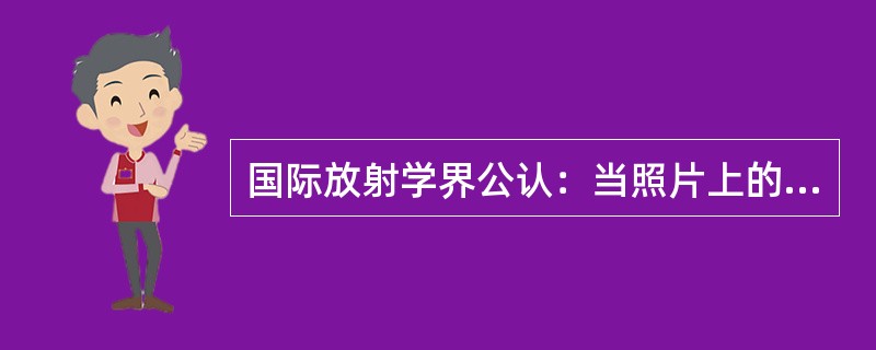 国际放射学界公认：当照片上的半影模糊值＜0.2mm时，人眼观察影像毫无模糊感，当半影模糊值＞0.2mm时，开始有模糊感，故0.2mm是模糊阈值。某球管在实验时，发现放大倍数为15倍时，开始模糊，则该焦