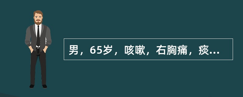 男，65岁，咳嗽，右胸痛，痰中带血丝1周。胸部后前位片示：右肺门影增大，右上肺大片状致密影，水平裂呈反“S”样改变。最可能的诊断是