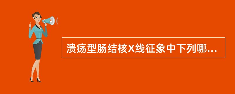 溃疡型肠结核X线征象中下列哪项不确切