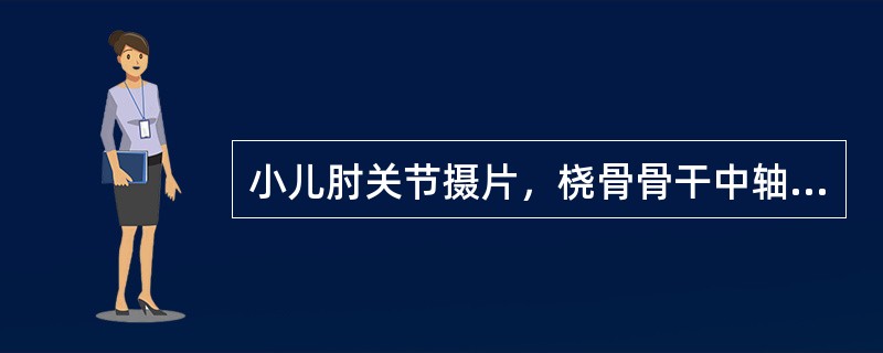 小儿肘关节摄片，桡骨骨干中轴线连线与肱骨小头骨骺中线不相连，应诊断为（）