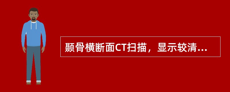 颞骨横断面CT扫描，显示较清楚的为（）