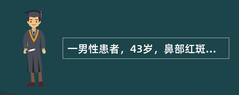 一男性患者，43岁，鼻部红斑5年，渐加重。嗜酒。体检：鼻尖部红斑、表面毛细血管扩张、丘疹、脓疱和结节。以下哪项诊断正确