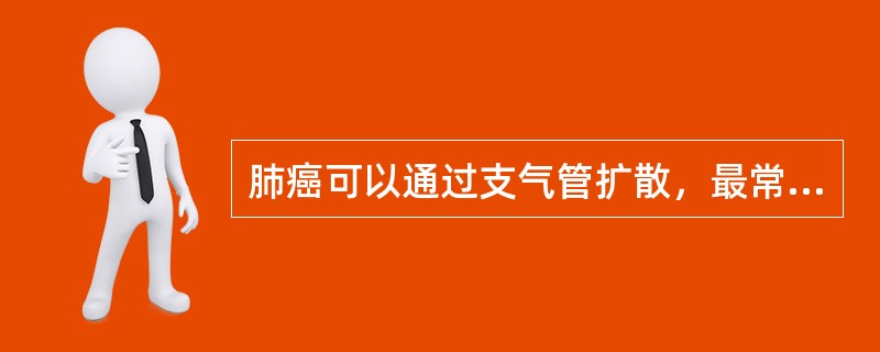 肺癌可以通过支气管扩散，最常见于