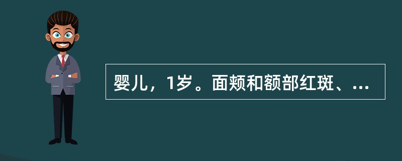 婴儿，1岁。面颊和额部红斑、丘疹、丘疱疹，有明显渗出和小的糜烂面与结痂。临床应诊断为