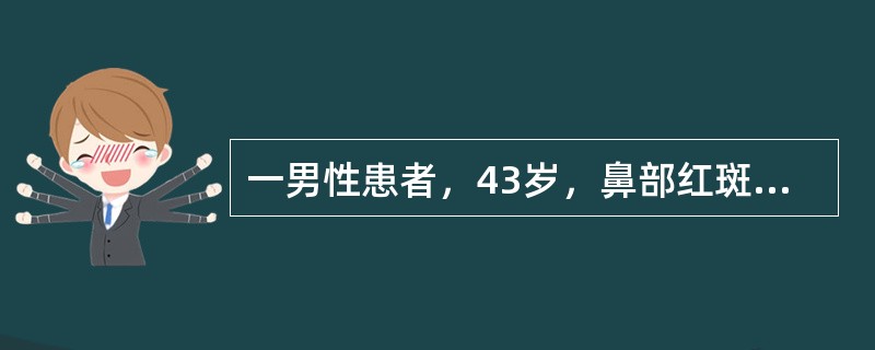 一男性患者，43岁，鼻部红斑5年，渐加重。嗜酒。体检：鼻尖部红斑、表面毛细血管扩张、丘疹、脓疱和结节。以下哪项诊断正确
