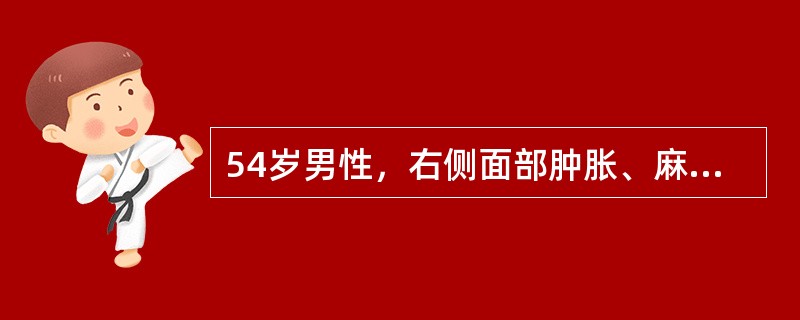 54岁男性，右侧面部肿胀、麻木2个月余，伴流涕，CT示右侧上颌窦内软组织密度，伴钙化，后外侧壁骨质消失，最可能的诊断是